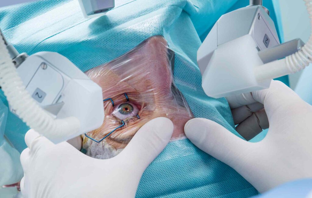 Jobs that may likely lead someone to do cataract surgery